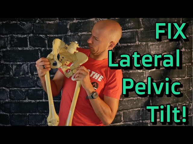 Lateral Pelvic Tilt Correction Exercises - Why It Happens and What YOU Can Do