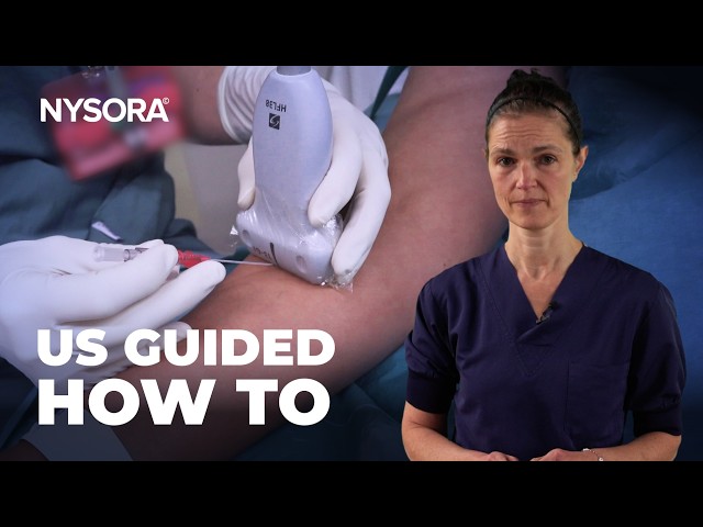 GUIDE TO ULTRASOUND-GUIDED IV ACCESS