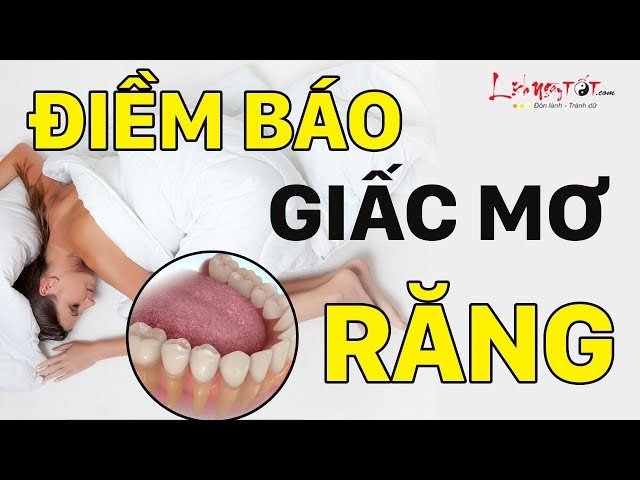 Nằm Mơ Thấy Răng Là Điềm Báo Gì Mơ Thấy Rụng Răng Nên Mừng Hay Lo Xem Là Biết - Giải Mã Giấc Mơ