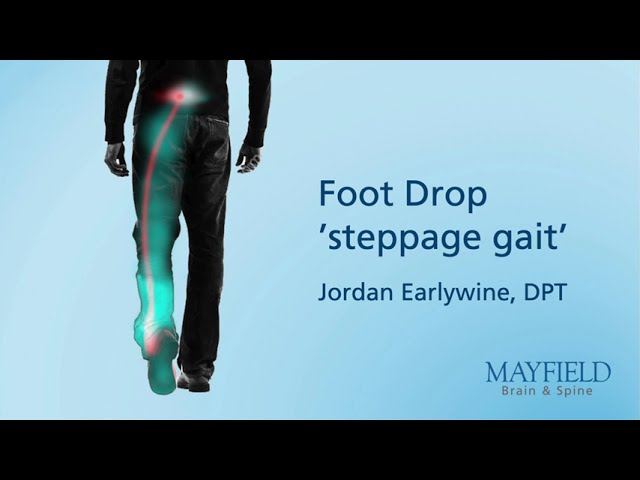 Foot Drop "steppage gait"