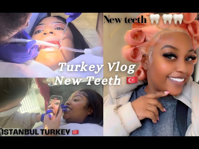 VLOG: I GOT MY TEETH DONE IN TURKEY II  MY WHOLE JOURNEY