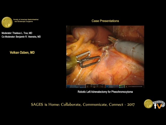 Robotic left adrenalectomy for pheochromocytoma