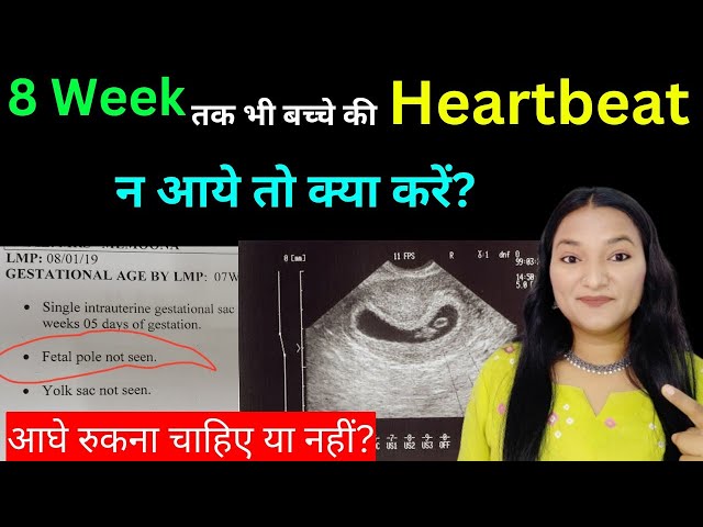 8 Week tak bhi Bacche ki Heartbeat na aaye to kiya kare? बच्चें की धड़कन न आने पर क्या करें?