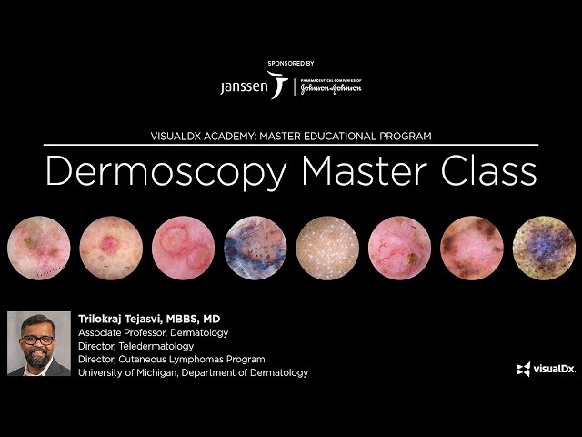 Dermoscopy Master Class