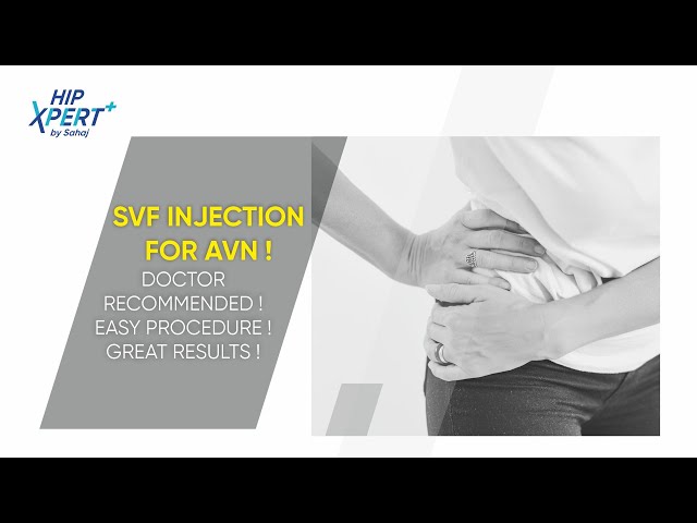 Dr. Vikrant Vijay Explained Hip AVN Causes - Avascular Necrosis of Hip Treatment | Hip Xpert