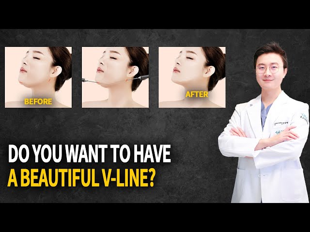 Face Liposuction | The most popular question!