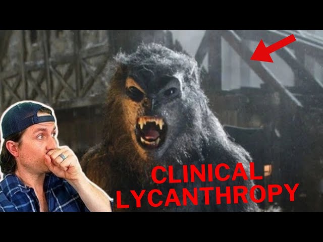 Episode 213 | Clinical Lycanthropy  - MrBallen Podcast: Strange, Dark & Mysterious Stories