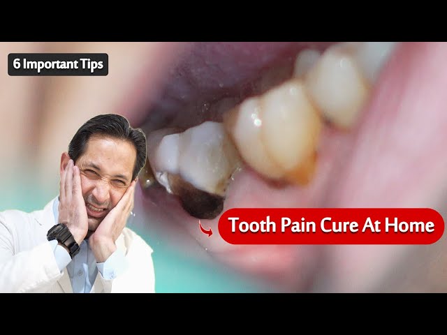 Sure Relief of Tooth Pain at Home | Tooth Pain / Toothache Relief in Emergency.