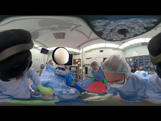 Left Knee, Arthroscopy Setup and Loose Body Removal -  GoPro Fusion 360