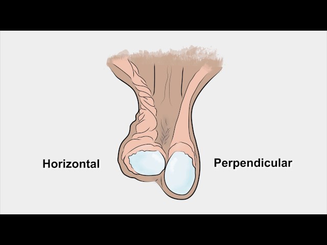 Examination of the Scrotum