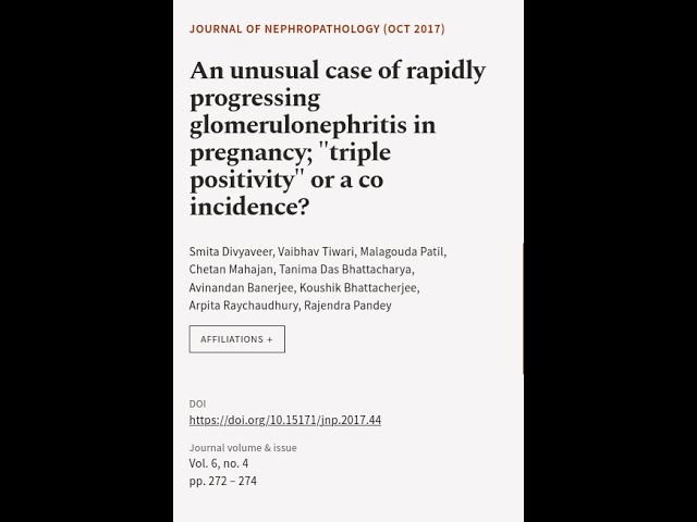 An unusual case of rapidly progressing glomerulonephritis in pregnancy; triple positi... | RTCL.TV