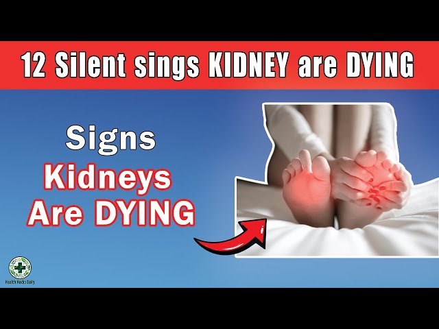 Are You Ignoring These 12 Silent Signs Of Kidney Failure?