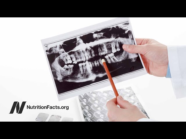 Plant-Based Diets: Oral Health