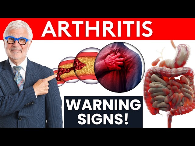 The 3 Types of Arthritis - Dr. Gundry Tells You The Warning Signs!