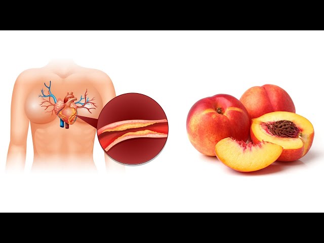 Cholesterol drops immediately! This home remedy for cholesterol is a real treasure!