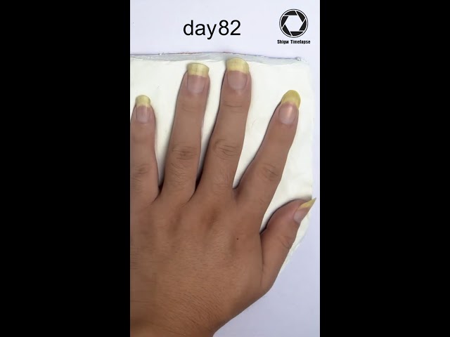 Fingernail Growing Time lapse - 90days #Shorts