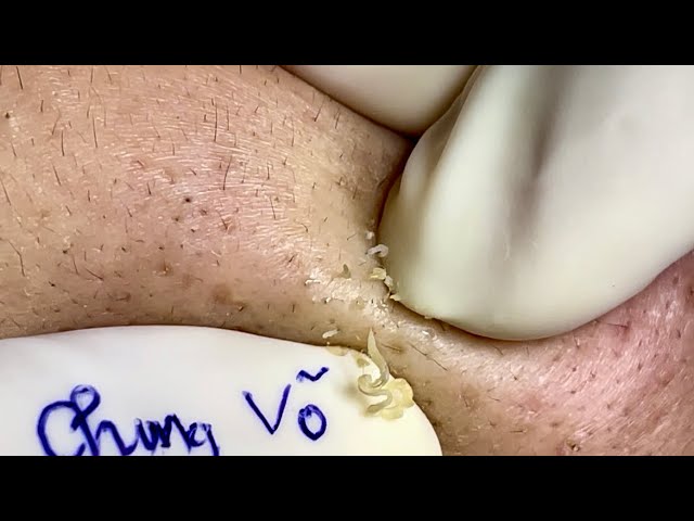 Satisfying video with Chung Vo Spa | 198