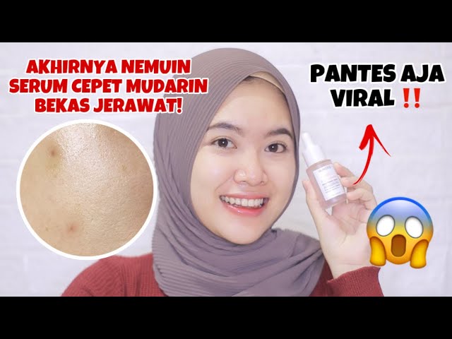 SERUM CEPAT MENCERAHKAN DAN MEMUDARKAN BEKAS JERAWAT HITAM! BENERAN SEBAGUS ITU?! | indrimeiliana