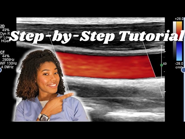 How to Perform Carotid Ultrasounds - A Simple Guide for Beginners