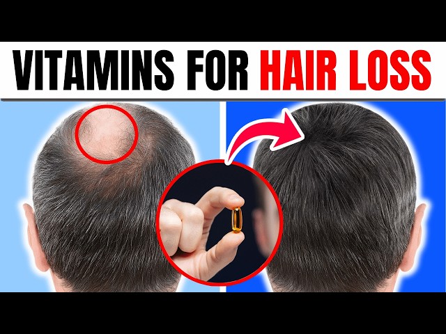 10 Essential Vitamins to Stop Hair Loss & Boost Growth!