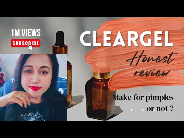 "Clear Gel for Pimples: My Honest Review & Results: Pros and Cons #cleargel #funtimeswithad👩