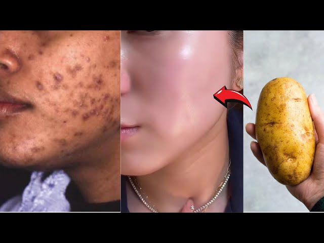 Japanese Secret for clear and dark spots free skin, glowing skin