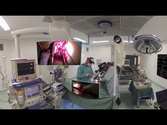 Virtual reality for neurophysiological spine surgery