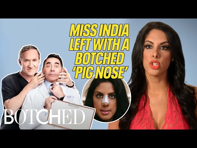 Miss India Winner Left With Botched "Pig" Nose Job (Before & After) | Botched | E!