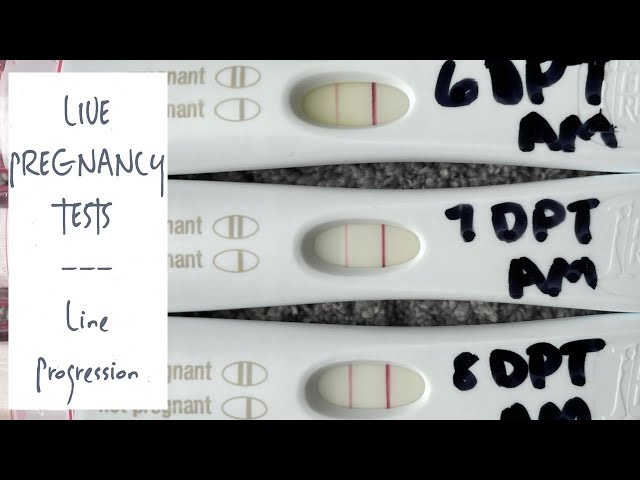 IVF Round #2 | LIVE PREGNANCY TESTS 7-8 DP5DT | TWW Symptoms | Becoming a Single Mom by Choice