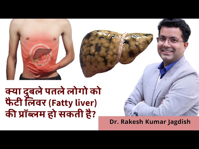 क्या दुबले पतले लोगो को फैटी लिवर (Fatty liver) की प्रॉब्लम हो सकती है? Lean NASH #Dr Rakesh Kuamr