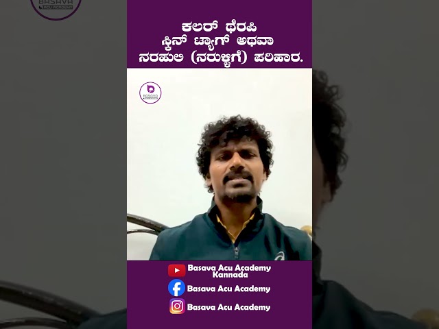 ಸ್ಕಿನ್ ಟ್ಯಾಗ್ ಅಥವಾ ನರಹುಲಿ (ನರುಳ್ಳಿಗೆ) ಪರಿಹಾರ.| Dr.Basavaraj K |