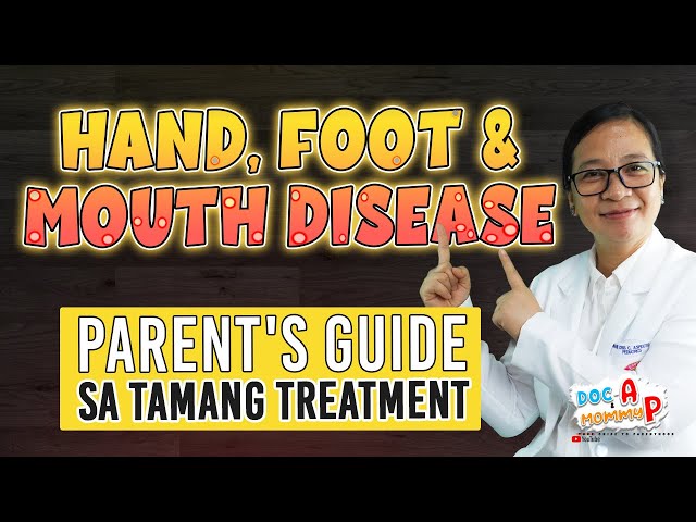 HAND, FOOT and MOUTH DISEASE - Parent's Guide sa Tamang Gamutan || Doc A Pediatrician