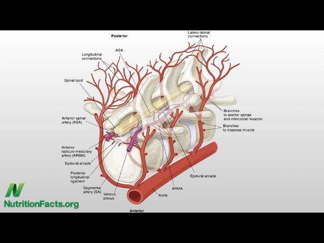 Cholesterol and Lower Back Pain