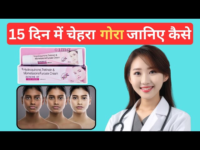 Elosone HT cream review 2024 | side effects and benefits | how to use Elosone ht cream