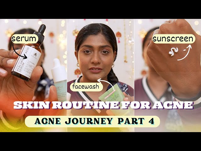 skincare for acne | oily acne prone skin | acne journey part 4 12/22