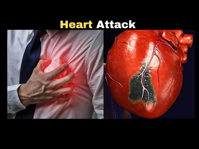 Heart Attack : Top 7 Warning Signs You Should Never Ignore!