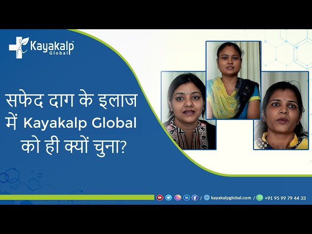 सफ़ेद दाग के इलाज में @kayakalpglobal1  को ही क्यों चुना? 📞 959 979 4433 | Kayakalp Global