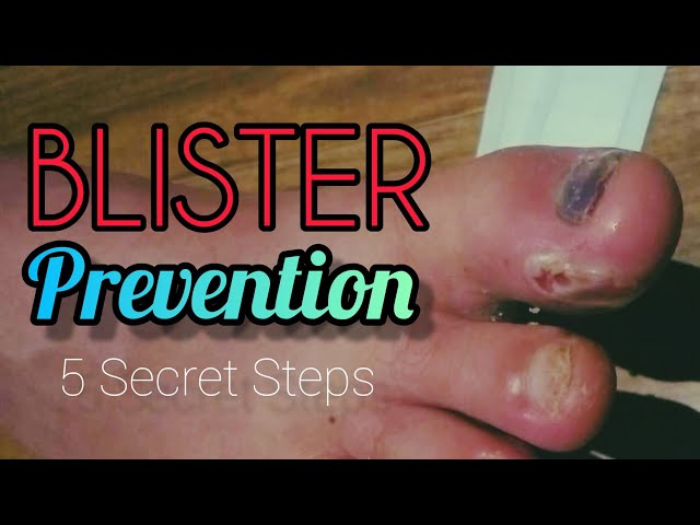 Blister Prevention & Sock & Shoe Selection - 5 Secret Steps to Success #hiking #hike #walking #walk