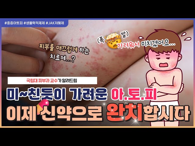 지긋지긋한 가려움에서 드디~어 해방..?😭 | 중증아토피도 치료한다는 💊신약들, 깔끔하게 정리해드립니다!👩‍🔬 - [언니네피부과]