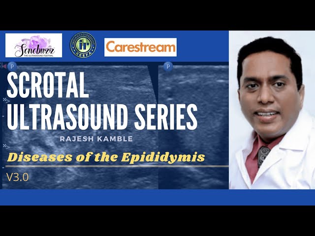 Diseases of the Epididymis || Dr Rajesh Kamble || Ultrasound Scrotum || Epididymitis