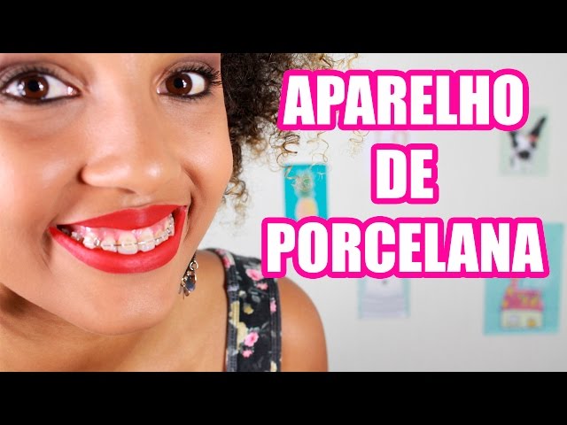 Meu aparelho de porcelana | Aparelho estético