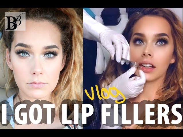 Vlog: I GOT LIP FILLERS | Dr. Liliya Made Beauty Medi Spa | BRITTANY BRINSON