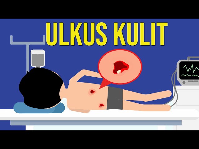 Apa yang Menyebabkan Luka Borok? (Ulkus Kulit)