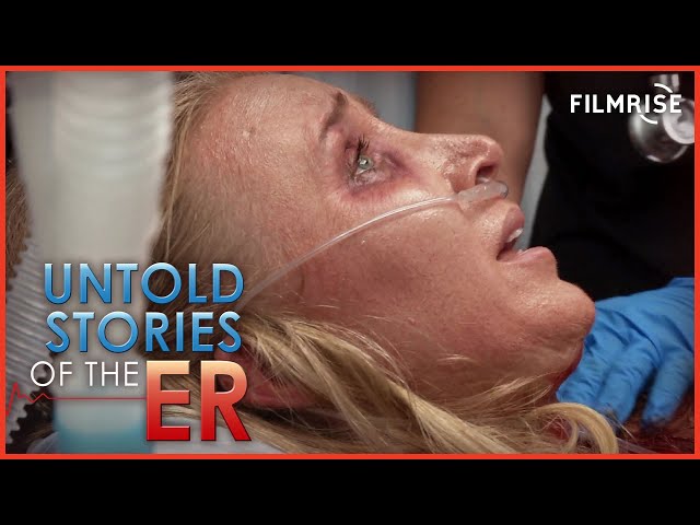 Untold Stories of the ER - Season 10, Episode 6 - Face Off