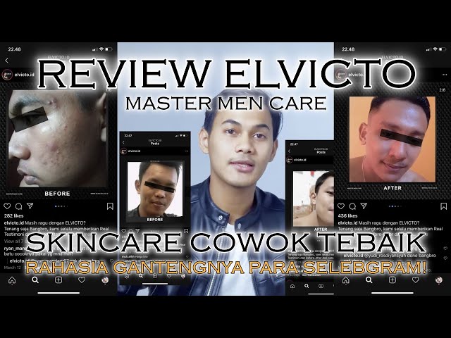 ELVICTO ! SKINCARE UNTUK MENCERAHKAN TERBAIK BUAT COWOK!