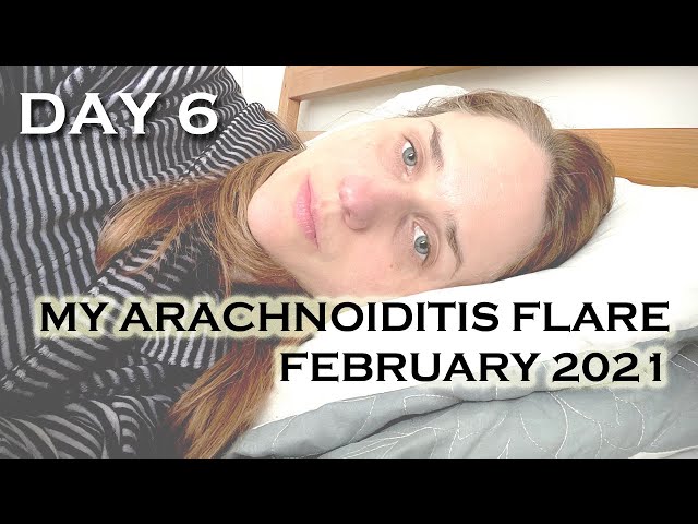 DAY 6 ARACHNOIDITIS & SPINAL CSF LEAK FLARE: February 2021