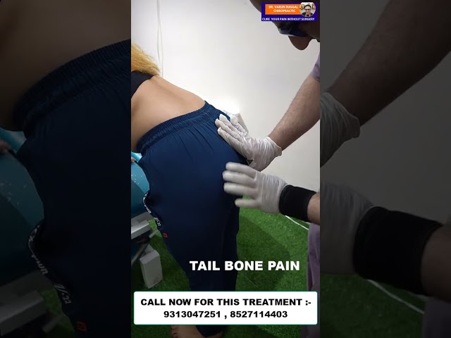 CHIROPRACTIC TREATMENT IN BIHAR | TAIL BONE PAIN | DR. VARUN DUGGAL #shortfeed #bihar #chiropratic