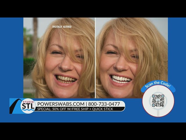 Power Swabs offers 50% off teeth whitening for Valentine’s Day! 