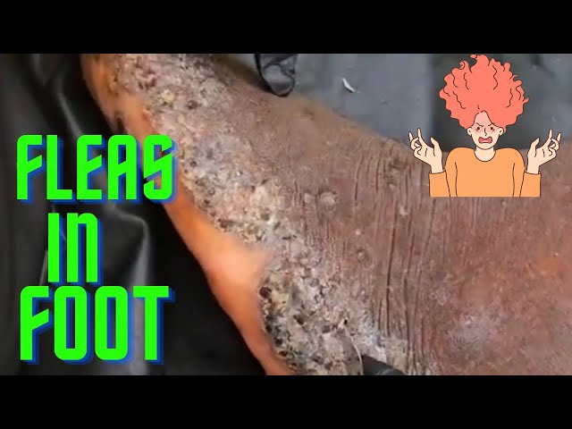 Removing FLEAS from foot || Jiggers and rot 😳 #asmr #fleas #infection #parasite #fungus