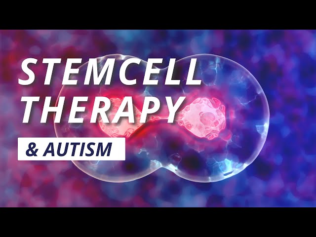 Apakah Stem Cell Therapy Terbukti Menolong ASD?